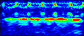IP67 0,001 mm di alta risoluzione B Scansione a larga gamma 15000 mm di spessore ultrasonica